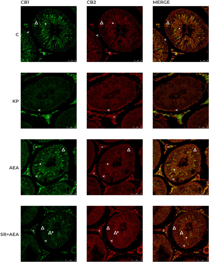 Distribution of CB1 and CB2 in rat testis treated with KP and AEA. Double immunofluorescence of CB1 (green) and CB2 (red) expression in control (C), kisspeptin (KP), anandamide (AEA), and SR141716A plus AEA (SR + AEA)-treated animals (n = 4 for each group). Magnification = C and KP ×63; AEA and SR + AEA, ×40. * Elongated spermatids, ↑ spermatocytes, ^ spermatogonia, Δ Sertoli cells, ° interstitium.
