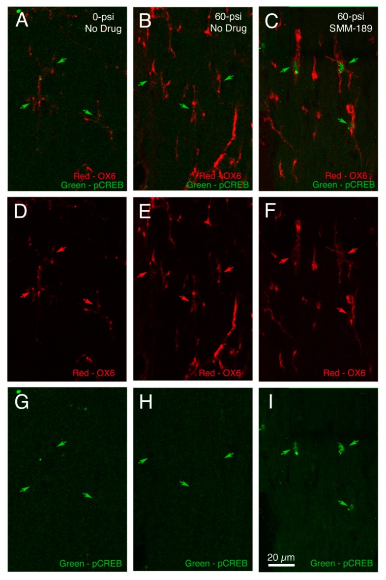 Double immunostaining for the activated microglial marker OX6 (major histocompatibility complex (MHC) class II antigen, red) and phosphorylated-CREB (the cyclic adenosine monophosphate (cAMP) response element binding protein, green) in the right optic tract of a 60-psi blasted mouse treated with SMM-189 (C,F,I) three days after blast compared to a sham blasted mouse not treated with SMM-189 (A,D,G) seven days after sham, and a 60-psi mouse not treated with SMM-189 (B,E,H) five days after blast. The first row (A–C) shows merged images, while the second (D–F) and third (G–I) rows show the red and green channels, respectively. Note that OX-6 immunostaining is more intense and found in more microglia after 60-psi blast (red arrows) compared to sham blast regardless of SMM-189 treatment (second and third columns). Phosphorylated-CREB, however, is evident in microglial nuclei (green arrows) only after SMM-189 treatment (last column).