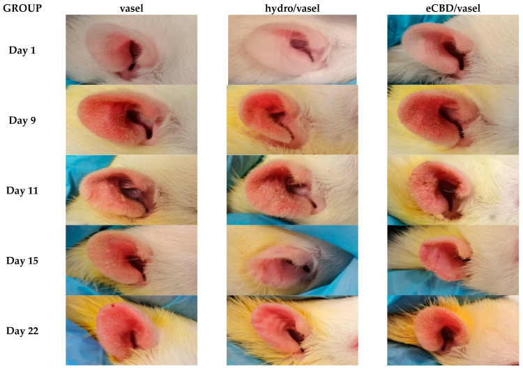 Therapeutic effect of high-cannabidiol Cannabis sativa L. extract (eCBD) ointment on DNCB-induced dermatitis in rats. The effect of the ointment containing 2% cannabidiol (eCBD/vasel) was compared to those of Vaseline (vasel) and ointment containing 1% hydrocortisone (hydro/vasel), which served as an active control. The 2,4-dinitrochlorobenzene (DNCB) solution was administered 9 times over a period of 3 weeks, and the tested ointments were applied starting on day 11. The application of the ointments containing eCBD and hydrocortisone resulted in the alleviation of inflammatory lesions compared to Vaseline, as observed on days 15 and 22. Treatment with eCBD resulted in a reduction of redness and swelling compared to day 9, before treatment.