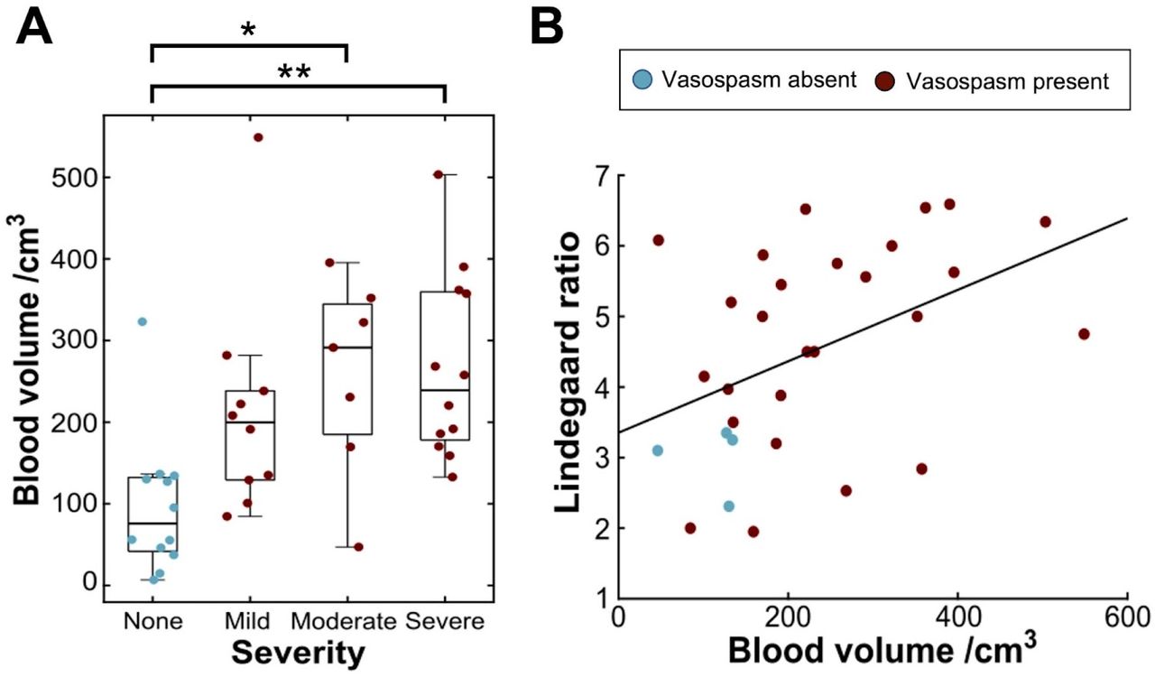 Associations between subarachnoid blood volume and metrics of severity of radiological vasospasm.A: Boxplots of blood volume grouped by radiologist’s impression of subjective severity of vasospasm. B: Scatter plot showing the greatest recorded Lindegaard ratio from TCD plotted against normalised blood volume. (* = p <.05, ** = p<.01)