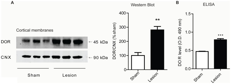 DOR levels increase in cortex of lesioned animals. A, Representative Western Blot and quantification for DOR and CNX in cortical membranes from 3 individual sham or lesioned animals. Data represent Mean ± SEM (n = 6 animals/group). Statistically significant differences between sham and lesion groups are indicated **, p<0.01 (t-test). B, ELISA data for DOR in cortical membranes from sham and lesioned animals. Data represent Mean ± SEM (n = 4 animals/group). Statistically significant differences between sham and lesion groups are indicated ***, p<0.001 (t-test).