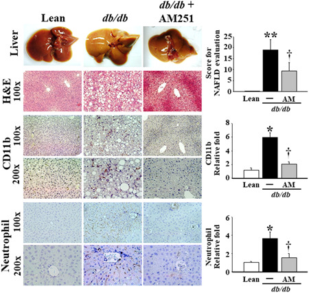 Effects of AM251 on tissue morphology and histopathological changes in the liver tissue of db/db mice. Liver tissues from the Lean control mice and db/db mice treated with or without 5 mg/kg AM251 were fixed in 10% formalin for H&E and IHC stain against CD11b (macrophages) and Neutrophils. Results for the H&E stain and IHC stain are shown at ×100 and ×200 magnification, and the dark brown color indicates the sites of CD11b and Neutrophils, respectively. The pathological lesion score of NAFLD was performed according to histological scoring system for NAFLD 20 and the images of CD11b and Neutrophils IHC stains at ×200 magnification were quantified using Panthera L Smart Light Microscope system. *P < .05 vs Lean control mice (n = 8); † P < .05 vs db/db mice (n = 8). H&E, hematoxylin and eosin; IHC, immunohistochemistry; NAFLD, nonalcoholic fatty liver disease