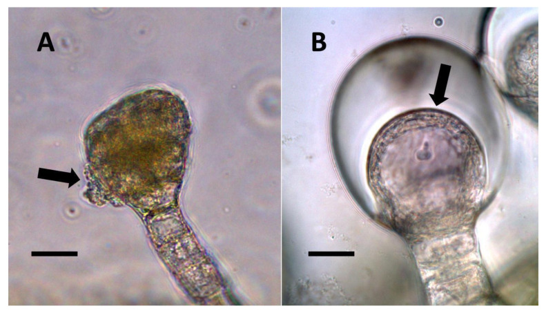 Glandular trichomes of Lonicera japonica and Citronella mucronata. (A) Developing glandular trichome of Lonicera japonica stained with iron sulfate to show nitric oxide (brown color) in trichome and bacteria emerging from trichome (arrow) (Bar = 10 µm). (B) Glandular trichome of Citronella mucronata stained with iron sulfate to show nitric oxide (brown color) (arrow) around bacteria in hair (Bar = 10 µm).