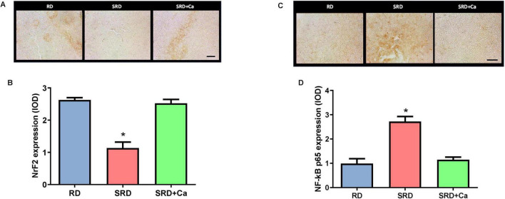 Panel A presents three microscopic images comparing NFf2 expression in RD, SRD, and SRD plus Ca groups, showing visible differences in staining. Panel B is a bar graph showing significantly reduced NFf2 expression in SRD compared to RD and SRD plus Ca groups. Panel C displays three microscopic images comparing NF-κB p65 expression in the same groups, with SRD showing more intense staining. Panel D is a bar graph showing significantly increased NF-κB p65 expression in SRD compared to RD and SRD plus Ca groups. Asterisk denotes statistical significance.
