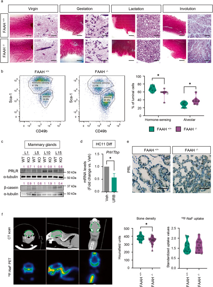 FAAH is necessary for the generation of hormone-sensing luminal cells and a functional PRLR-β-casein axis in the mouse mammary gland.a Representative whole-mount pictures and H&E-stained sections of FAAH +/+ and FAAH −/− mouse mammary glands harvested at different time points of adult development (virgin, gestation day 15, lactation day 15, and involution day 2). n = 2 mice per time point. Scale bar = 1 mm (whole mount) and 200 μm (H&E). b Representative flow cytometric analysis of MEC populations of FAAH +/+ and FAAH −/− virgin mammary glands. CD24+ CD49f- luminal cells were isolated and then separated into hormone-sensing or alveolar lineages based on their expression of Sca-1 and CD49b (see Methods). n = 7 mice per group. c Representative WB analysis of β-casein and PRLR at L1, L5, L10 and L15. Densitometric values after normalization against α-tubulin and WT condition for every time point are depicted in purple. d qPCR analysis of Prlr mRNA expression in HC11 cells after being differentiated in the presence of the FAAH inhibitor URB597 at 5 μM. Expression levels were normalized against Tbp. Data are shown as mean ± SEM of n = 7 biologically independent experiments. Student’s t-test: *p < 0.05. e IHC detection of PRL in samples at L10. Scale bar = 200 μm. f Left, representative images of the computed tomography (CT), showing the area of study (the skull) in green, and of the positron emission tomography (PET) with 18F-NaF, showing a heat map visualization of the 18F-NaF uptake. Right, results of the CT scan (skull bone density) and the 18F-NaF PET (18F-NaF uptake) expressed in Hounsfield units and standardized uptake values, respectively. n = 12 and 18 mice in the FAAH +/+ and FAAH −/− breastfeeding group, respectively.