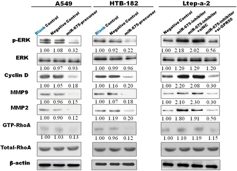 miR-675-5p-mediated inhibition of the GPR55 signaling pathway. In A549 and HTB-182 cells with miR-675-5p overexpression, the protein levels of p-ERK, Cyclin D, GTP-RhoA, MMP9 and MMP2 (left and middle, lane 3) were significantly decreased compared with the control. In Ltep-a-2 cells with miR-675-5p down-regulated expression, the protein levels of p-ERK, Cyclin D, GTP-RhoA, MMP9 and MMP2 (right, lane 2) were significantly increased compared with the negative control(right, lane 1) and si-GPR55 treatment abrogated the increased expression of these genes induced by miR-675-5p in the cells (right, lane 4). However, the expression of these genes has not changed in Ltep-a-2 cells (stable down-regulation of miR-675-5p) transfected with non-specific control siRNA (si-NC) (Figure 7, right, lane 3). Knockdown of GPR55 inhibited the expression of GPR55 and its main target genes, similar to miR-675-5p (right).
