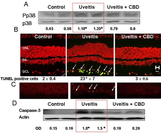 Cannabidiol reduces p38 MAPK activation and prevents cell death in the uveitic retina. A: Lipopolysaccharide (LPS) treatment of rats resulted in a significant increase in p38 MAPK activation at 24 h. CBD (5 mg/kg) treatment reduced this effect. Data from 2 animals in each group are shown (asterisk represents that it is significantly different at p<0.05 as compared to control), Similar results were obtained in 2 independent experiments. B: CBD blocked neuronal cell death, as detected by TUNEL analysis. Data shown is the mean±SEM of 3 animals in each group (asterisk represents that it is significantly different at p<0.05 as compared to control). C: Colocalization of phospho-p38 MAPK (red) and TUNEL+cells (green) in the retinal ganglion cell layer. CBD blocked LPS-induced activation of p38 MAPK and blocked neuronal cell death. D: CBD blocked LPS-induced caspase-3 expression that was detected by Western analysis in the uveitic retina. Data from 2 animals in each group are shown (asterisk represents that it is significantly different at p<0.05 compared to control). Similar results were obtained in 2 independent experiments.