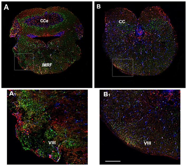 Distribution of OX-2R (red) and CB1R (green), and their co-localization OX-2R/CB1R (yellow) in coronal sections of the rhombencephalon. (A,B) OX-2R/CB1R co-expression has been observed in the IMRF and octaval nerve (VIII). (A1,B1) Higher magnification of the fields boxed in (A,B) showing the OX-2R/CB1R co-expression in the VIII. DAPI (Blue) was used as a counterstaining to show nuclei. Cce, corpus cerebelli. Scale bar, 250 μm for (A,B); 50 μm for (A1,B1).