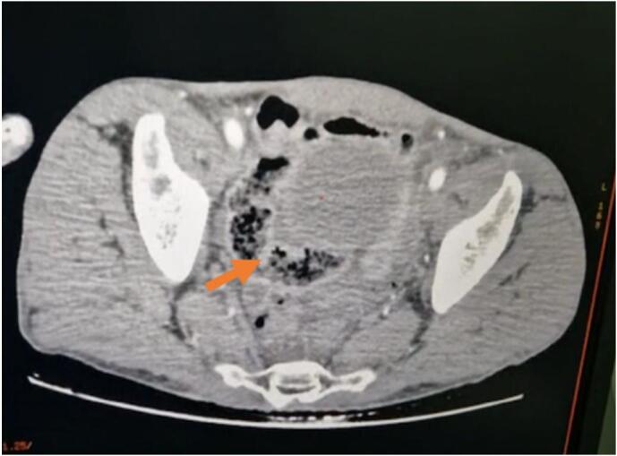 Fig. 1