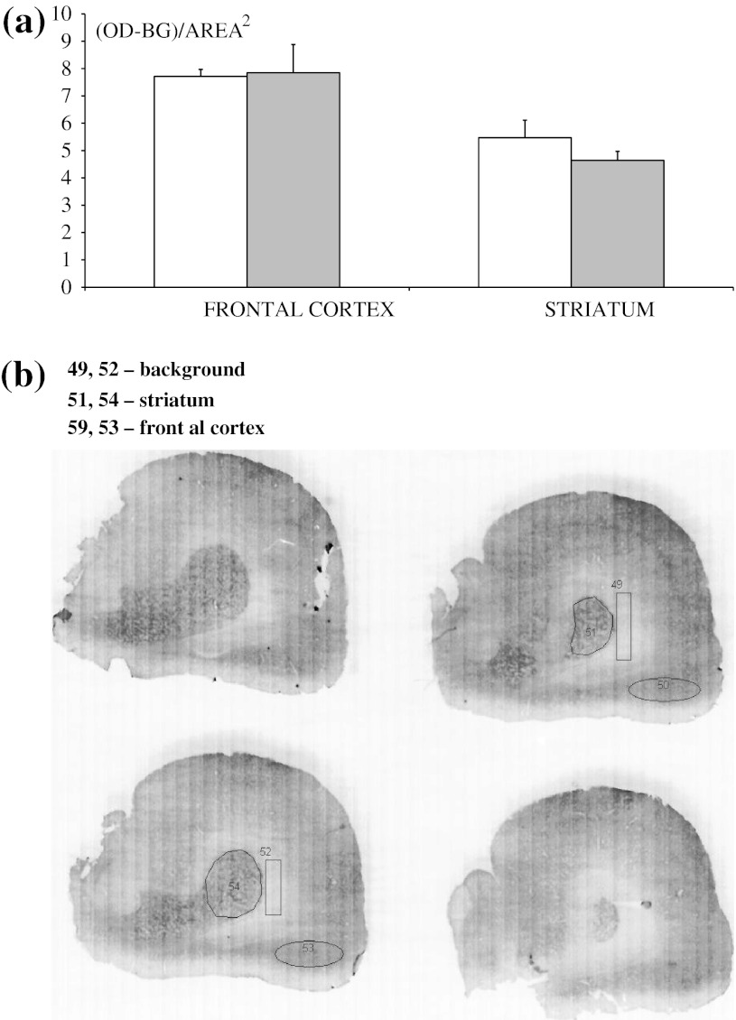 Effect of neonatal DSP-4 lesioning (50 mg/kg sc on the 1st and 3rd days of postnatal life) on CB1 receptor immunoreactivity, assessed densitometrically in brain slices in the frontal cortex and striatum of adult rats. a Results are shown as the mean ± SEM (n = 7 per group) in arbitrary units of optical density (OD). b Representative CB1 receptor immunostained sections at the level of the corpus striatum with delineation of subregions of the corpus striatum and frontal cortex. Background was assessed in the region (shown as a rectangle) of the corpus callosum. Legend White square control, Grey square DSP-4