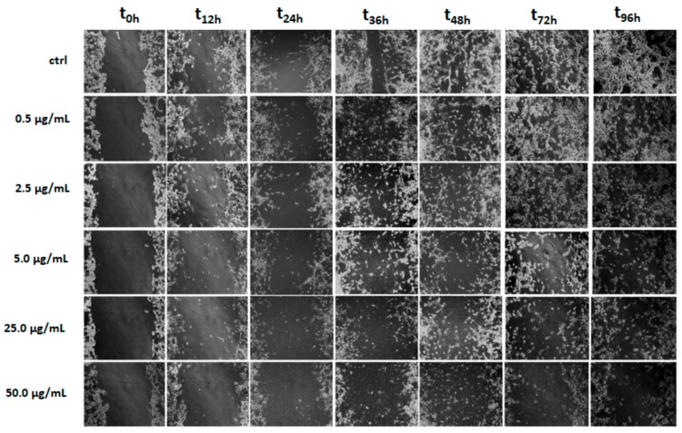 U-87 cells underwent a scraped wound and were then treated with different LnHS doses (0.5, 2.5, 5, 25 and 50 μg/mL). Cells were photographed immediately following the scratch (0 h), after 12, 24, 36, 48, 72 and 96 h. Untreated cells (ctrl), were used as a control. Representative figures are shown from one of two independent experiments.