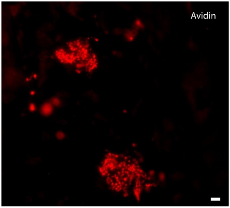 Mast cells scattered in the dermis. Fluorescence microscopy, scale bar = 10 μm.