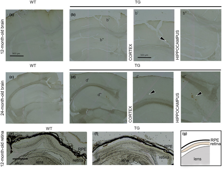 Immunohistochemistry of β‐amyloid in WT and TG brains. Representative brain cryosections of WT and TG mice stained with anti‐β‐amyloid immunohistochemistry (IHC). (a) 12‐month‐old WT, (b) 12‐month‐old TG, (b’) high magnification of cortex, (b”) high magnification of hippocampus. (c) 24‐month‐old WT, (d) 24‐month‐old TG, (d’) high magnification of cortex, (d”) high magnification of hippocampus. Scale bars: 900 and 300 μm. The black arrows indicate the β‐amyloid plaques. (e, f) Representative eye cryosections stained with anti‐β‐amyloid IHC in WT and TG mice respectively. Scale bar: 400 μm. (g) Schematic representation of ocular tissues visible in images e and f.
