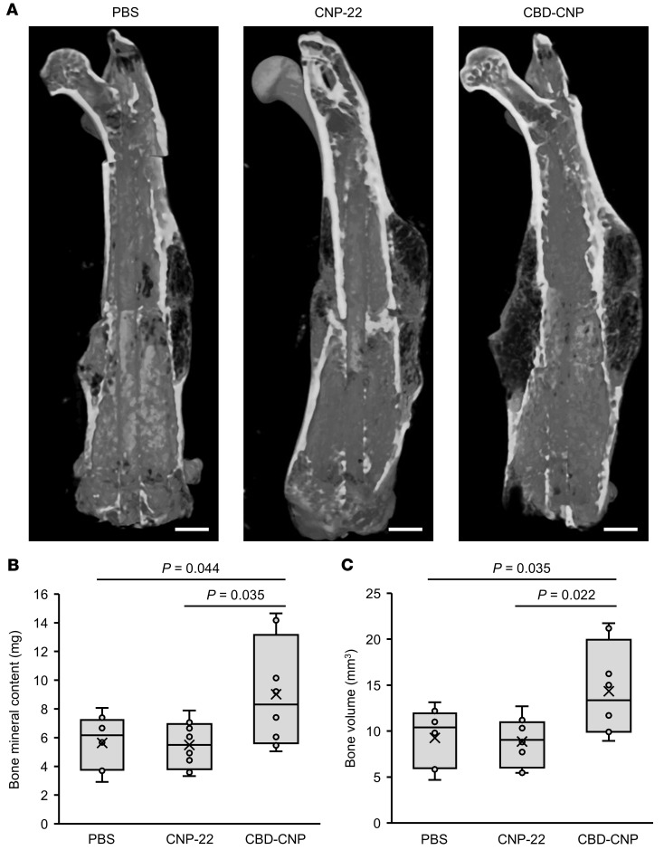 CBD-CNP increases bone volume in the C57BL/6J mouse model of bone fracture.(A) Representative μCT images of the fracture site of femurs treated with collagen powder mixed with either PBS, CNP-22, or CBD-CNP. (B and C) Bone mineral content and bone volume of each group measured by μCT images (n = 8). Scale bars: 1 mm in A. Statistical analysis was performed by using 1-way ANOVA followed by Tukey post hoc tests. CT, computed tomography; PBS, phosphate-buffered saline.