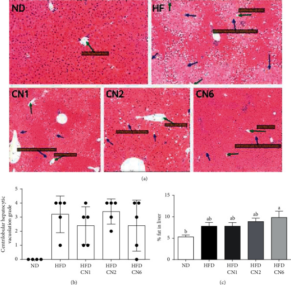 Effect of cannabis extracts on the liver in mice fed with a high-fat diet. (a) Representative liver H&E staining. (b) Steatosis grade. (c) Total lipids in 100 mg liver. All values are expressed as mean ± SEM (n = 8–10). Columns marked with different letters (a, b) are significantly different (p < 0.05). Histopathological changes were scored by the study pathologist, using semiquantitative grading of four grades (0–4), taking into consideration the severity of the changes (0: no lesion; 1: minimal change; 2: mild change; 3: moderate change; and 4: marked change).