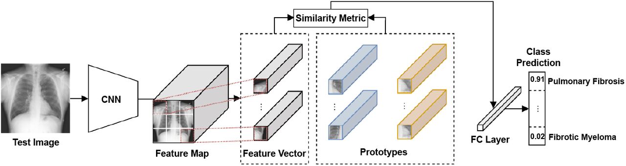 Prototype Explanation using CNN for Chest X-ray Test Image. Adapted from [21]. This image is licensed under CC BY 4.0.