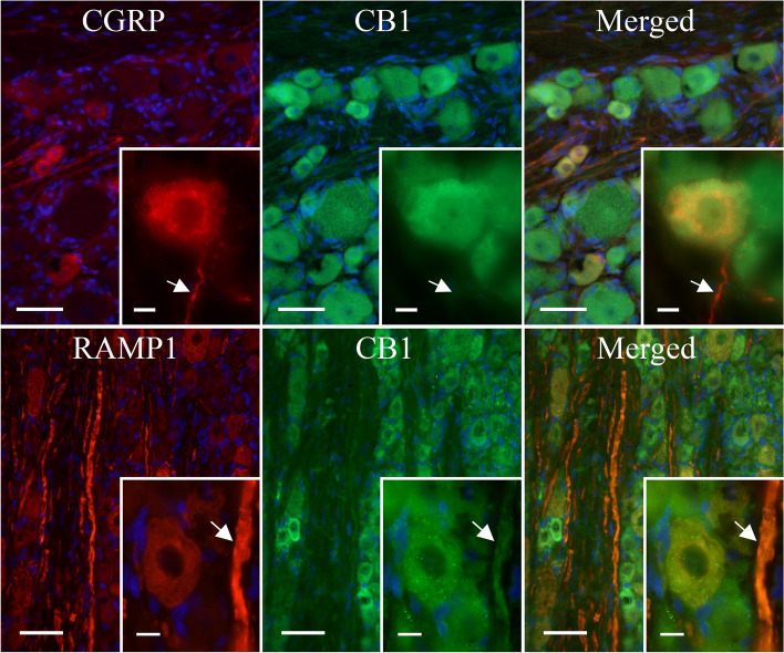 The expression of CB1, CGRP and RAMP1 in the TG. IHC localization of CB1, CGRP and the functional CGRP receptor (by staining for RAMP1) in the TG. Blue represents cell nuclei; orange represents colocalization of CGRP (upper panel) or RAMP1 (lower panel) with CB1; globular regions represent neuronal somas and fibrous regions represent individual neuronal fibres. Large image scale corresponds to 50 mm, and the insert scale corresponds to 10 μm. The arrows mark unmyelinated C-fibres (upper panel) and myelinated Aδ-fibres (lower panel)
