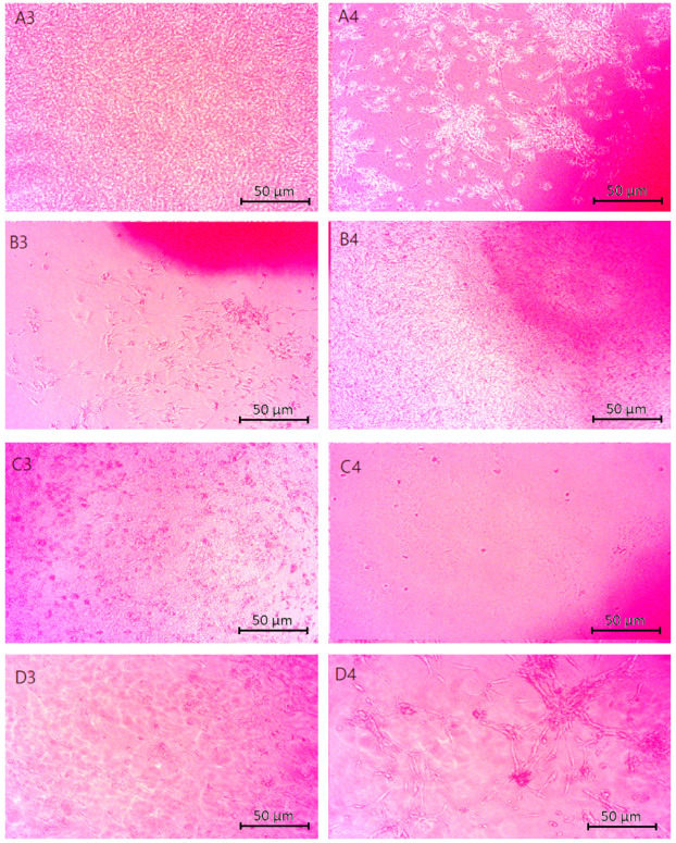 Microscopic images (40× magnification) of chitosan biomaterials modified CBD cytotoxicity results performed on nerve cells (astrocytes): (A3,A4) Asp:Glu 0.84:0, (B3,B4) Asp:Glu 0.5:0.5, (C3,C4) Asp:Glu 0.7:0.3, (D3,D4) Asp:Glu 0.3:0.7.