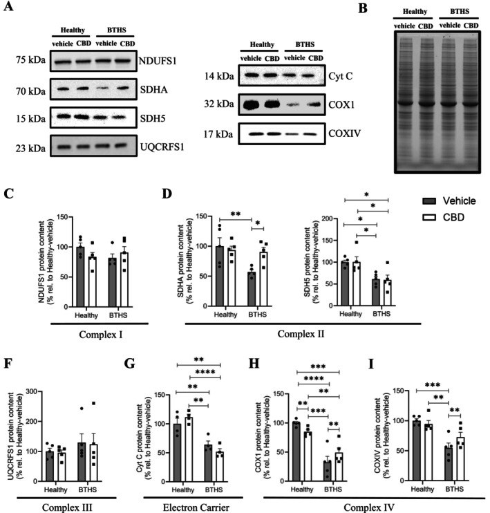 CBD fully restores relative SDHA content and partially restores COXI and COXIV content in BTHS B‐lymphoblastoids. Representative immunoblots (A) with images of total protein loading (B) are shown, with quantitation of band densities for NDUFS1 (C), SDHA (D), SDH5 (E), UQCRFS1 (F), Cyt C (G), COXI (H), and COXIV (I). Data are presented as means ± S.E.M, n = 4–5. *p < 0.05, **p < 0.01, ***p < 0.001, ****p < 0.0001.