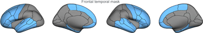 Frontal–temporal mask (shown in blue) derived from the cortical parcellation of the Desikan-Killiany Atlas [48]