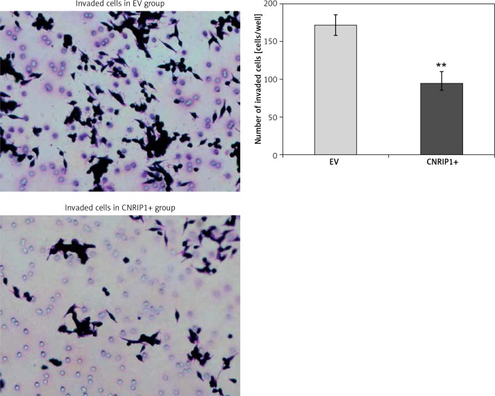 Invasion of colon cancer cells transfected with a CNRIP1-overexpression plasmid. Transfection of SW620 cells with a CNRIP1-overexpression plasmid significantly reduced their invasiveness (94.00 ±16.24 cells/well) when compared to the invasiveness of SW620 colon cancer cells transfected with an empty vector (171.83 ±13.93 cells/well; t = 9.642; p < 0.001)