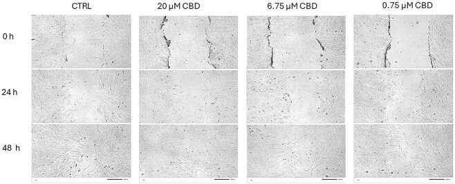 Effects of CBD on migration of equine normal fibroblasts in a scratch assay. Representative phase contrast microscopy images of equine normal skin fibroblasts in a wound healing (scratch) assay aftertreatment with CBD at concentrations of 0.75, 6.75, and 20.0 μM. The control condition consisted of 0.1% DMSO (vehicle control). Images were taken at 0, 24, and 48 hours after scratch formation to qualitatively observe cell migration. Each condition was performed in triplicate. No significant differences in wound closure were observed between the groups. Scale bar = 200 μM.