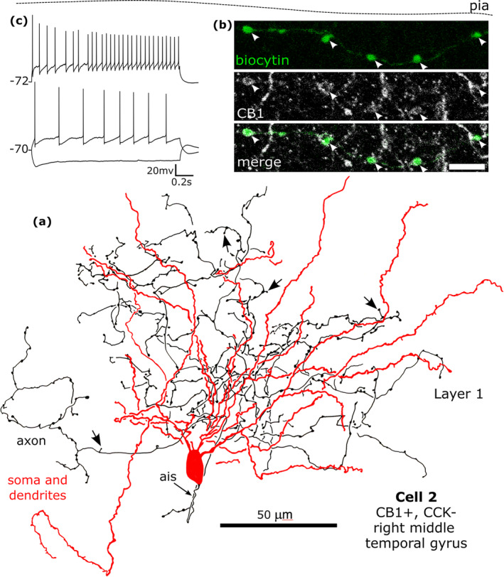 A CB1‐immunopositve rosehip neuron recorded in vitro and labelled by biocytin that was CCK‐immunonegative in layer 1. (a). Reconstruction of the recovered parts of the cell (cell 2 in Figure 8f) with soma and dendrites (red) and a high density of axon with frequent stalked boutons (arrows). (b) The biocytin‐labelled axon and boutons (green) were CB1‐positive (e.g. arrowheads). Maximum intensity projection of optical slices, Z‐stack total depth: (b), 2.1 μm. (c) Voltage responses of the cell to current injections of rheobase, RB + 100 pA (upper trace), and holding current −100 pA; a small voltage sag was detected to the hyperpolarising current injection. The cell fired regularly with moderate spike frequency acceleration and strong spike amplitude accommodation when continuously depolarised. Scale bar: (b) 5 μm.