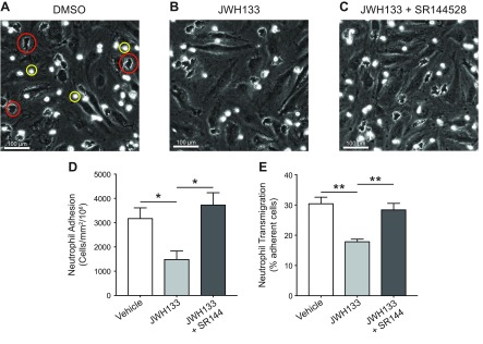 The CB2 agonist JWH133 blocks the endothelial adhesion and transmigration of human neutrophils in a CB2-dependent manner. A–C) Representative images of human PMNs adhered to (yellow circle) or transmigrated through (red circle) TNF-α–activated endothelial cells that were preincubated with either 1% DMSO (A), JWH133 (1 µM) (B), or JWH133 + SR144528 (both 1 µM) (C). D, E) Total adhesion (D) and transmigration (E) were quantified. Data are means + sem (n = 6 independent human donors). Statistical analysis was conducted by 1-way ANOVA with Holm-Sidak’s multiple comparisons correction. *P < 0.05, **P < 0.01.