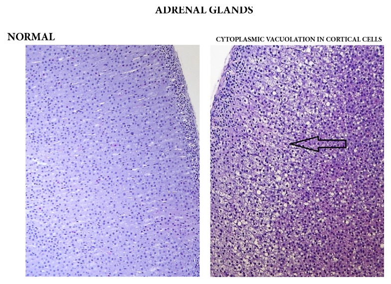 Adrenal cortex: comparison of normal (control) cortical cells to cells in a male from the 3000/4000 mg/kg bw/day group showing cytoplasmic vacuolation, 14-day study.