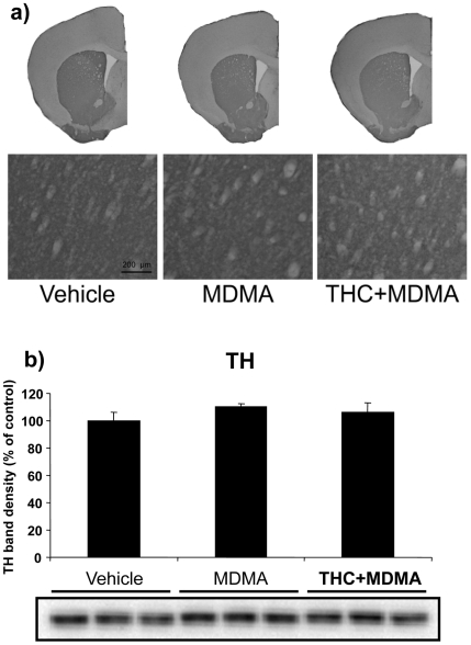 MDMA does not decrease TH levels in the striatum at room temperature.TH immunostaining (a) and protein levels (b) in the striatum of animals treated with THC (3 mg/kg, i.p.) and MDMA (20 mg/kg, i.p.) housed at 21±1°C. Animals were sacrificed and tissue was removed 48 h after the last injection. A representative TH immunostaining (a) is shown. TH band densities (b) were quantified. Data are expressed as mean ± SEM of percentage of density compared to controls (n = 3).