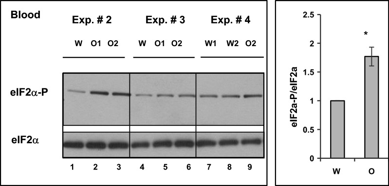 Chronic oxycodone treatment activates the Integrated Stress Response in rat blood. Western blot analysis of phosphorylated eIF2α in rat blood. Left panel, equal amount of total protein from blood of rats treated with oxycodone (O1, O2) or water (W) corresponding to samples presented in Fig. 2a. was analysed by western blot probed with anti-phospho eIF2α and total eIF2α. Right panel, graph representing mean value of phospho-eIF2α to total eIF2α ratio normalized to that in water samples set as one (± SEM; n = 4 water and n = 5 oxycodone (three sets of experiments that analyzed samples from 8 water and 13 oxycodone treated rats; p = 0.048). Statistical analysis of carbonyl content in oxycodone relative to water exposed cortex lysates was performed using Student’s t-test