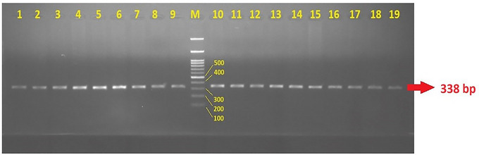 Agarose gel electrophoresis image of the 338 bp PCR product of the FAAH rs324420 gene polymorphism (M: DNA ladder; 1–19: 338 bp PCR product).