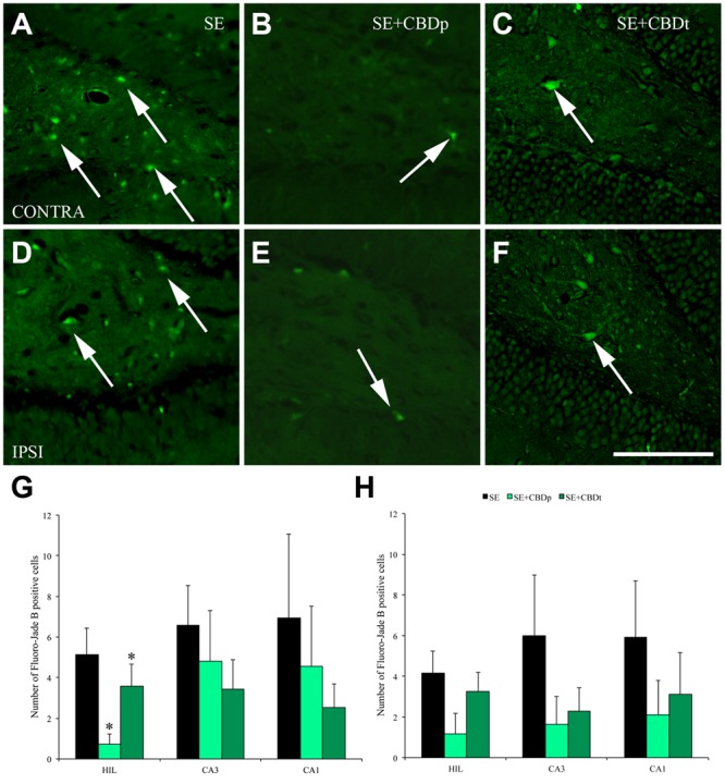 Protective action of CBD over neuronal degeneration 3 days after pilocarpine-induced SE, evaluated by Fluoro-Jade B (FJB) staining. (A–F), representative micrographs from the contralateral (A–C) and ipsilateral (D–F) hilus of a SE rat (A,D), SE+CBDp rat (B,E), and a SE+CBDt rat (C,F). Similar to 1 day evaluation, SE rats presented higher number of FJB positive neurons in both hilus (arrows in A,D), compared to CBD-treated rats (B,C,E,F). SE+CBDp (medium green bars) and SE+CBDt (dark green bars) had a lower number of FJB positive neurons in the contralateral hilus (G), compared to SE group (black bars), with no difference in CA3 and CA1 contralateral (G), or in the ipsilateral hippocampus (H; ANOVA followed by Sidak post hoc test). The white bar in F indicates 100 μm and the ∗ indicates differences from SE group. Data were presented as mean ± standard error.