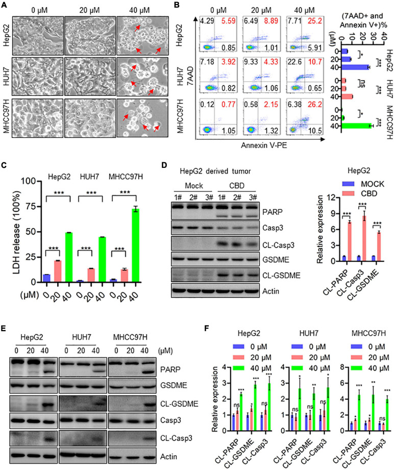 CBD induces cell pyroptosis in HCC cells. (A) Representative morphological changes of HepG2, HUH7, and MHCC97H cells in response to different concentrations of CBD. (B) Flow cytometry analysis of cell apoptosis after the HepG2, HUH7, and MHCC97H cells treated with different concentration of CBD for 24 h. Cells were collected and stained with Annexin V-PE/7AAD. Data are presented as mean ± SD. (C) LDH release assays were performed on CBD exposed HepG2, HUH7, and MHCC97H cells for 24 h. (D) Western blot analysis of PARP, Caspase-3, CL-Caspase-3, GSDME, and CL-GSDME in CBD treated tumor tissues derived from HepG2 cells. Actin was used as a loading control. The graphs represent the mean ± SEM. (E,F) Western blot analysis of PARP, Caspase-3, CL-Caspase-3, GSDME, and CL-GSDME in CBD treated HepG2, HUH7, and MHCC97H cells after 24 h, and actin was used as a loading control. The graphs represent the mean ± SD. The meaning of ‘*‘ is statistically significant. *p < 0.05, **p < 0.01, ***p < 0.001, n.s. represents no significance.