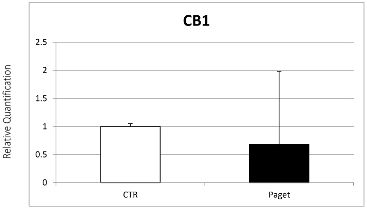 Comparison between CB1 mRNA expression evaluated with RT-PCR from 2 OCs of subjects with PDB and 2 healthy controls. Results were normalized for the housekeeping gene β-Actin and were showed as mean ± SD of three independent experiments on each individual sample.