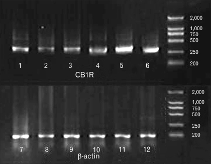 Representative reverse-transcription polymerase chain reaction (RT-PCR) for cannabinoid type 1 receptor (CB1R) in distal colon, proximal colon and distal small intestine. Band of 1, 2 and 3 represent PCR for CB1R in distal colon, proximal colon and distal small intestine from the rats of the sham partial restraint stress (PR) group; 4, 5 and 6 represent PCR for CB1R in distal colon, proximal colon and distal small intestine from the rats of the PR group. 7, 8 and 9 represent PCR for β-actin of controls in distal colon, proximal colon and distal small intestine from the rats of the sham PR group; 10, 11 and 12 represent PCR for β-actin of controls in distal colon, proximal colon and distal small intestine from the rats of the PR group.