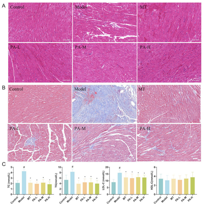 (A) H&E (200×) of Myocardium. (B) Masson (200×) of Myocardium. (C) The levels of blood lipid indicators (TC, TG, HDL-C, LDL-C) (n = 6). The data are mean ± SD. In comparison to the control group, # p < 0.05. In comparison to the model group, * p < 0.05.