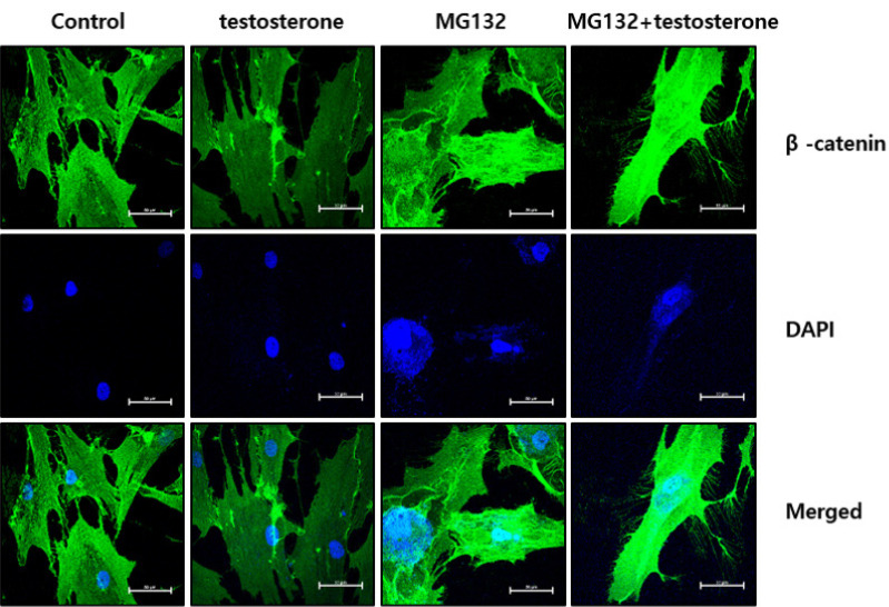 Ubiquitination pathway involves in the β-catenin down-regulation. Dermal papilla cells were pre-treated with MG132 for 6 hr, and then treated with testosterone. MG132 pretreatment restore the decreased β-catenin expression by testosterone.