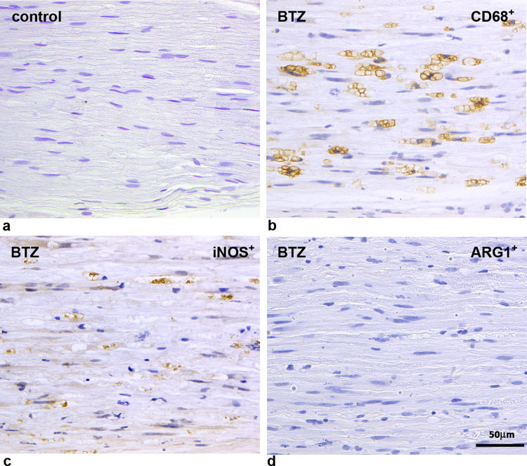 Representative images of macrophage infiltration in caudal nerves of a control and a bortezomib- (BTZ) treated rats taken from a previously published experiment [49] To investigate the macrophage infiltration immunohistochemistry was performed using anti-CD68 antibody to detect macrophage infiltrating cells (b) compared with control animals (a). In addition, anti-iNOS (inducible Nitric Oxide Synthase) antibody (c), and anti-ARG1 (Arginase-1) antibody (d) was used to discriminate M1 (proinflammatory) from M2 (anti-inflammatory) macrophages, respectively. While no infiltrating macrophages were observed in controls, marked M1 macrophage infiltration was present in the caudal nerves of BTZ-treated rats [49]
