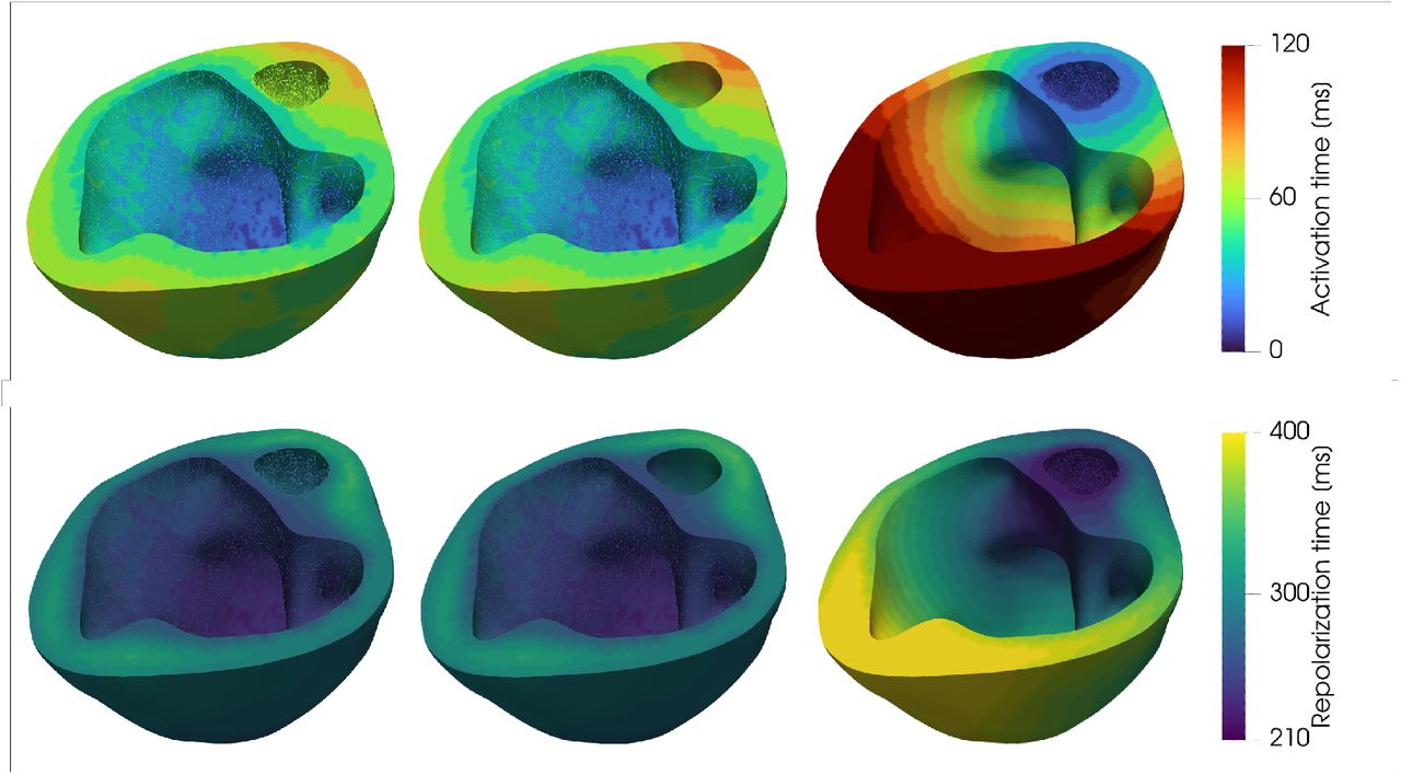 Running an in silico clinical trial. Activation (top) and repolarization (bottom) maps with personalized model parameters (left), left bundle branch block (center) and right bundle branch block (right).