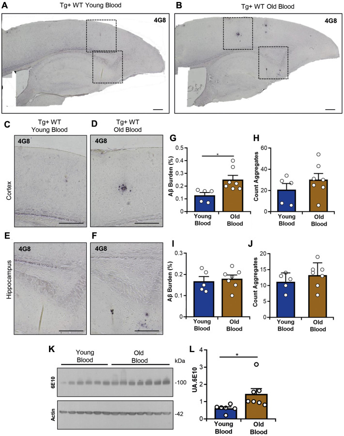 Evaluation of Aβ deposition and APP levels in Tg2576 mice treated with blood from old and young wild type mice. Representative images of Aβ accumulation in the cortex and hippocampus (A, B). Higher magnification images of the cerebral cortex (C, D) and hippocampus (E, F) are also shown. Tissue slices were probed with the 4G8 antibody as described in the Materials and Methods. Scale bars: 1,000 μm (A, B), 500 μm (C–F). Quantitative analyses of Aβ burden and plaque number in the cerebral cortex (G, H) and hippocampus (I, J) are displayed. (K) Representative western blot image showing APP levels in brain homogenates from blood-treated mice (upper panel), with actin used as a loading control (lower panel). (L) Densitometric quantification of APP levels shown in (K), expressed in arbitrary units (UA). Data include 5–7 animals per group, (random mix of males and females; young donor group: 1–3M/2–3F; old donor group: 1–3M/2–4F). Sex was not included as a variable in statistical analyses. Data values are expressed as mean ± SEM. Molecular weight markers (KDa) are indicated. Each lane represents one individual animal. Statistical analyses: Mann–Whitney U-test for panels (G) and (L); Student’s t-test for panels (H), (I), and (J). *p < 0.05, **p < 0.01.