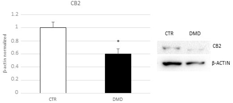 CB2 receptor protein expression levels in CTR and DMD-associated macrophages, determined by Western blot, starting from 15 μg of total lysates. The most representative images are displayed. The protein bands were detected through Image Lab. Ink software “BIORAD”, and the intensity ratios of immunoblots compared to CTR, taken as 1, were quantified after normalizing with respective controls. The relative quantification for CB2 receptor expression, normalized for the housekeeping protein β-actin, is represented in the histogram as the mean ± SD. Students’ t-test has been used for statistical analysis. *, p ≤ 0.05 compared to CTR (p-value: 0.0249).