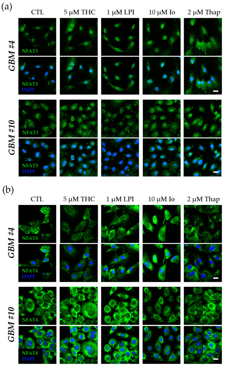 Influence of THC or LPI on the subcellular localization of NFAT3 and NFAT4 after 30 min. Representative images of NFAT3 (a) and NFAT4 (b) after 30 min of THC or LPI stimulation. In untreated control cells, NFAT3 (a) was mainly localized in the nucleus, and NFAT4 (b) was solely localized in the cytoplasm. Translocation of NFAT3 (a) and NFAT4 (b) after THC, LPI, ionomycin (Io), and thapsigargin (Thap) administration was not detectable in GBM #4 and GBM #10. Cell nuclei were counterstained with DAPI. Scale bar = 25 µm.