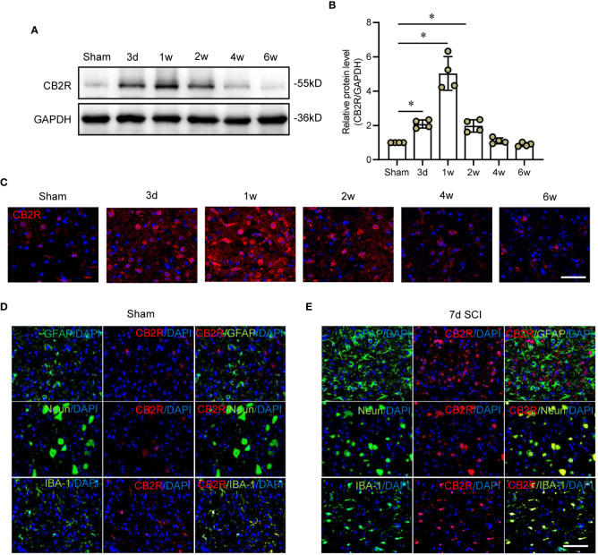 Expression patterns of CB2R in cord tissues post-SCI. (A) Representative protein band of CB2R on day 3 and weeks 1, 2, 4, and 6 post-SCI. (B) Quantitative analysis showing that CB2R expression was significantly increased on day 3 and weeks 1 and 2 post-SCI. (C) IF staining showing that CB2R (red) in cords of mice within 6W post-SCI. (D) IF staining of CB2R (red) with GFAP, Neun, or IBA-1 (green) in cords of sham mice. (E) IF staining of CB2R (red) with GFAP, Neun, or IBA-1 (green) in SCI mice on day 7 post-SCI. Scale bar = 100 μm. * p < 0.05.