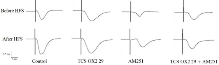 An original trace of the induced field potentials in the CA1 area at the pre-HFS (baseline) and post-HFS time-points