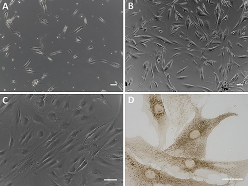 Fibroblasts derived from human hip fascia after digestion with Collagenase B: after 5 days from isolation (A), 1st passage (B), and 7th passage (C). Scale bars: 100 µm. D) Immunocytochemical assay on isolated cells (7th passage) with anti-fibroblast surface protein antibody (Abcam, 1:100). Scale bar: 50 µm.