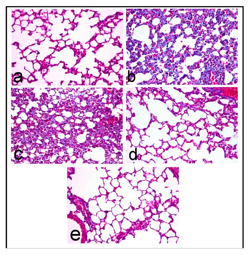 Lung of (a) control mice showing no collagen deposition; (b) BLM-treated mice showing intensely blue collagen fibers; (c) PRO-25 treated mice showing blue stained collagen fibers; (d) PRO-50 treated mice showing no collagen deposition; and (e) PRO-100 treated mice showing no collagen deposition. (Masson’s trichrome stain, 400×).