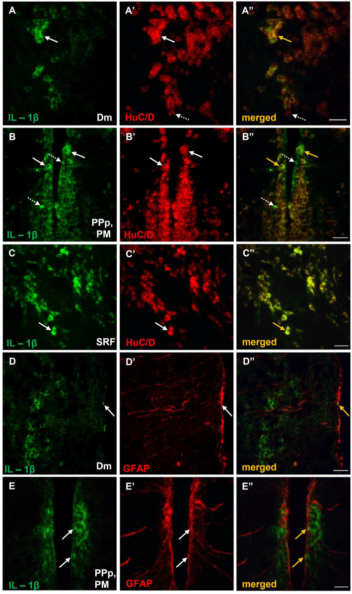 Expression of IL-1β in neurons and/or astrocytes within areas of the SDMN, in MK-801-treated zebrafish. (A–E’’) Immunofluorescent microphotographs of selected transverse sections showing colocalization of IL-1β with HuC/D (A–C”), or GFAP (D–E”) in medial zone of the dorsal telencephalic area (Dm) (A–A”,D–D”), parvocellular preoptic nucleus, posterior part/magnocellular preoptic nucleus (PPp, PM) (B–B”,E–E”) and superior reticular formation (SRF) (C). Arrows indicate examples of colocalization, dashed arrows point to single positive cells. Microphotographic images are representative of MK-801-treated fish, n = 5. Scale bar: 25 μm. ROI, region of interest.