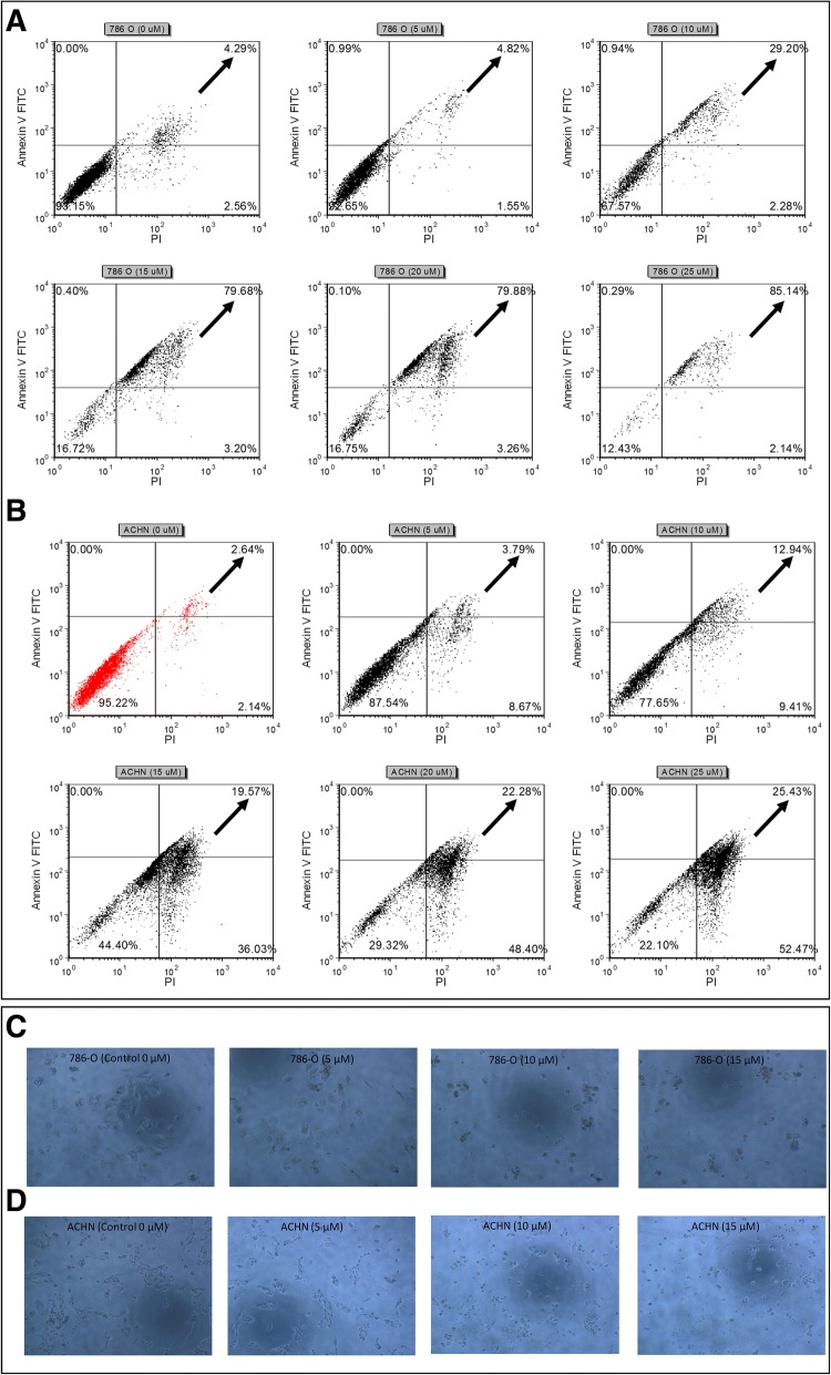WIN-55 induced apoptosis analysis in RCC cells. WIN-55 induced apoptosis of 786-O (a) and ACHN (b) cells as assessed by flow cytometry using Annexin V-FITC and PI. Black arrows in each dot plot represents increase in late apoptotic cells with increased concentration of WIN-55. Morphological changes of 786-O (c) and ACHN (d) cells treated with increasing concentrations of WIN-55 for 48 h and examined under light microscopy [* p < 0.05 vs control (0 μM)]