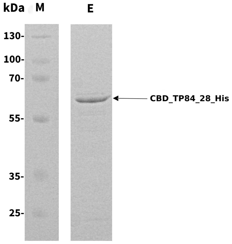 SDS-PAGE analysis of the purified CBD_TP84_28_His. M, PageRuler Plus Stained Protein Ladder; E, CBD_TP84_28_His. Arrow points at a band corresponding in size to the endolysin CBD_TP84_28_His (64.2 kDa).